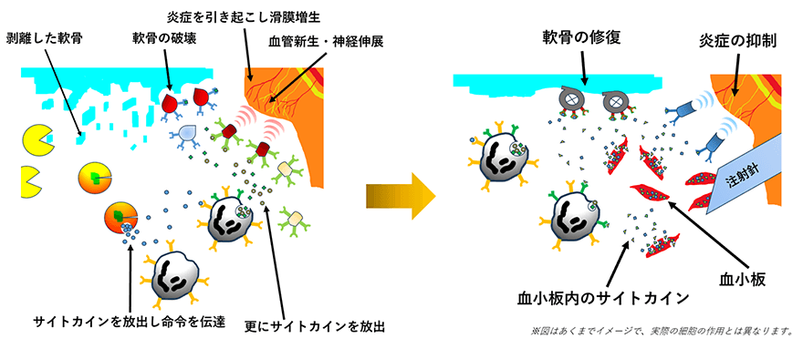 画像:PRPの作用